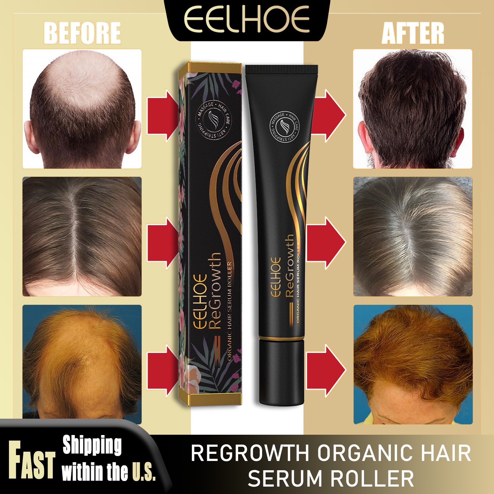 Hair Care Natural Products - EELHOE Regrowth Hair Serum With Roller