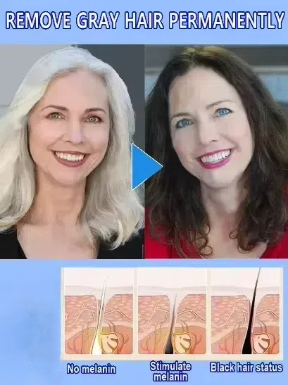 White hair killer, remove gray - Hair Care Natural Products 리뷰 및 가격