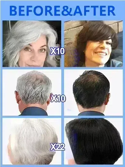 White hair killer, remove gray - Hair Care Natural Products 리뷰 및 가격