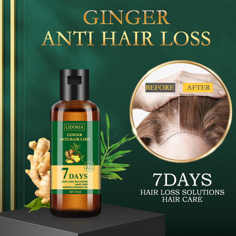 35ml Natural Ginger Hair Care  - Hair Care Natural Products 리뷰 및 가격