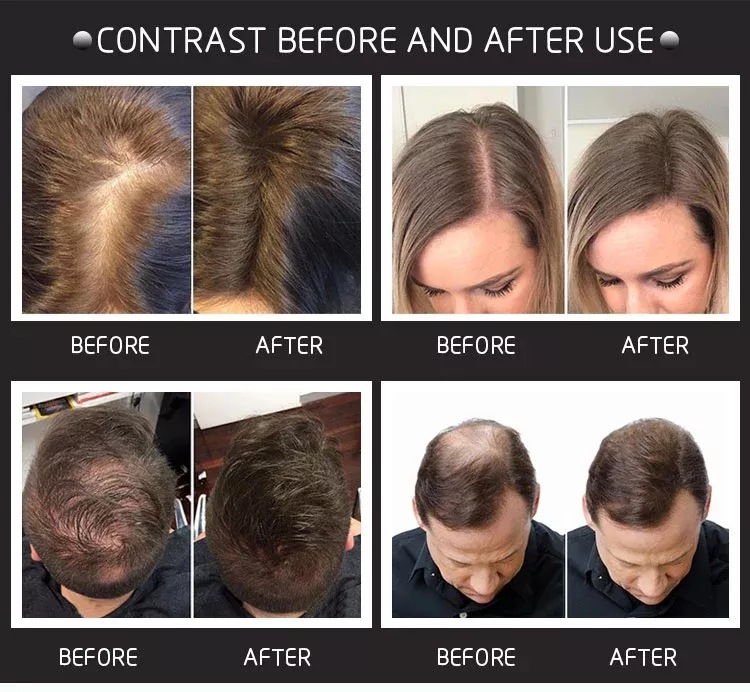 28g Hair Building Fibers come  - Hair Care Natural Products 리뷰 및 가격