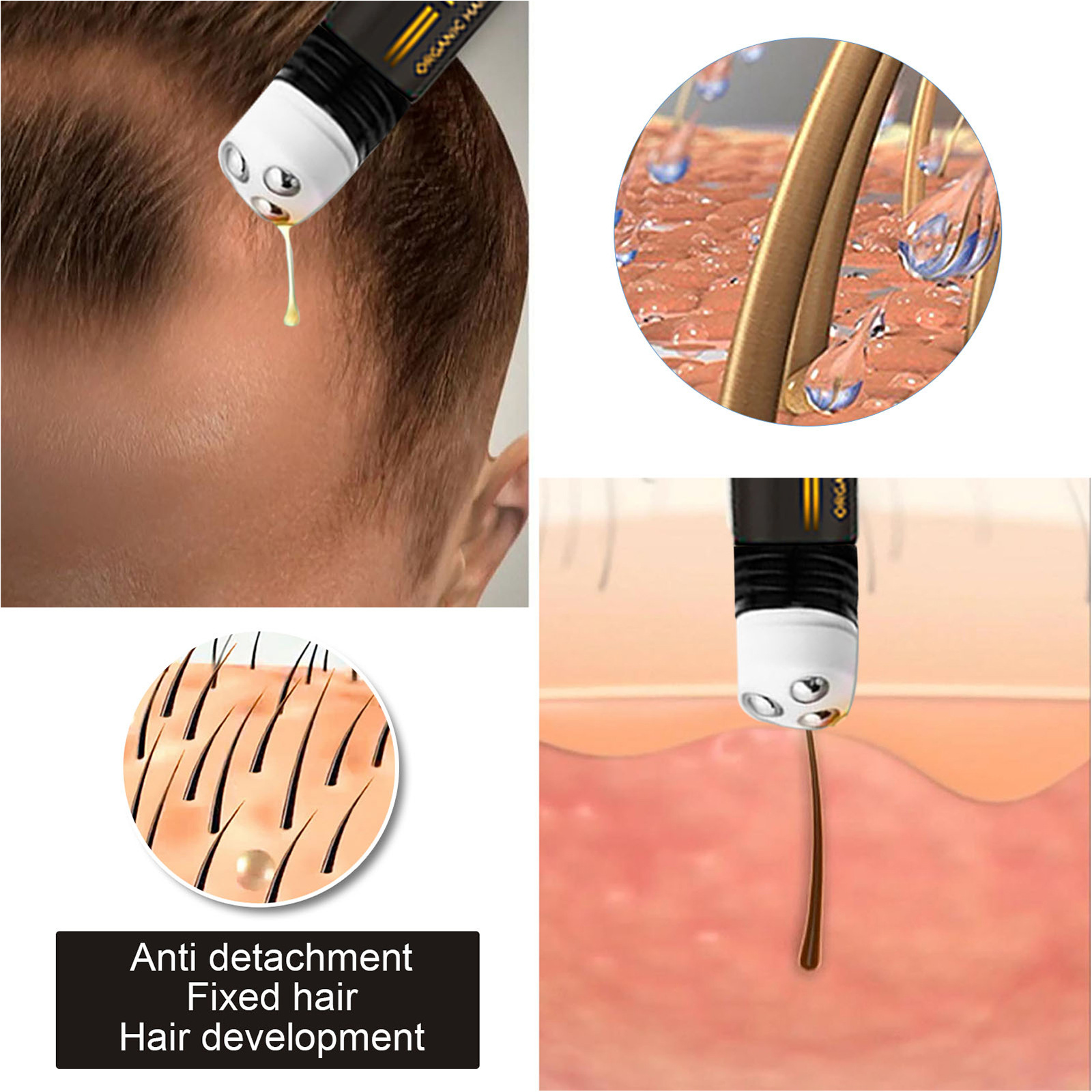 EELHOE Regrowth Hair Serum Wit - Hair Care Natural Products 리뷰 및 가격