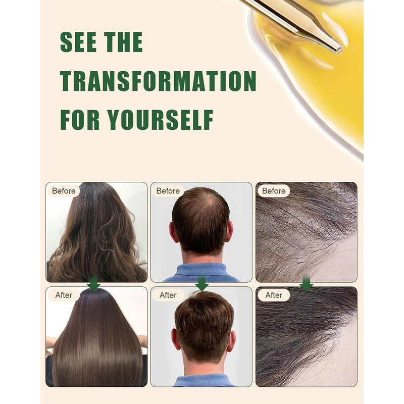 Batana Rosemary Hair Care Esse - Hair Care Products 리뷰 및 가격