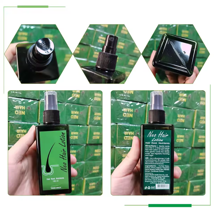 Original Neo Hair Lotion 120ml - Hair Care Natural Products 리뷰 및 가격