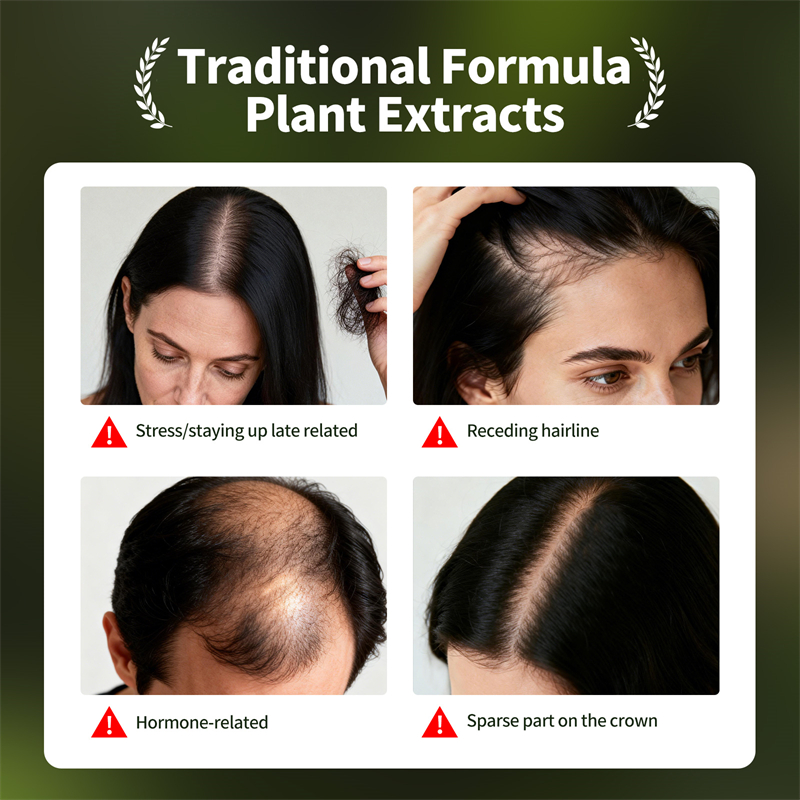 Natural Hair Growth Set Usman  - Hair Care Natural Products 리뷰 및 가격