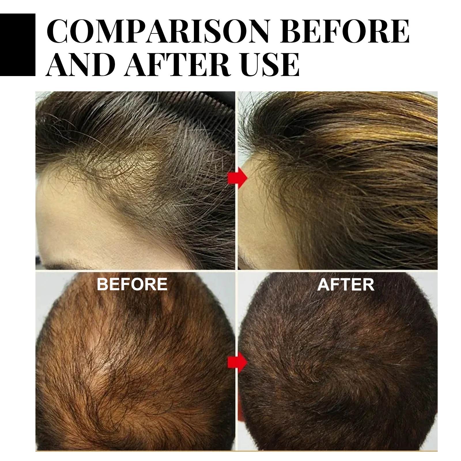 Ginger Hair Growth spray Anti  - Hair Care Products 리뷰 및 가격