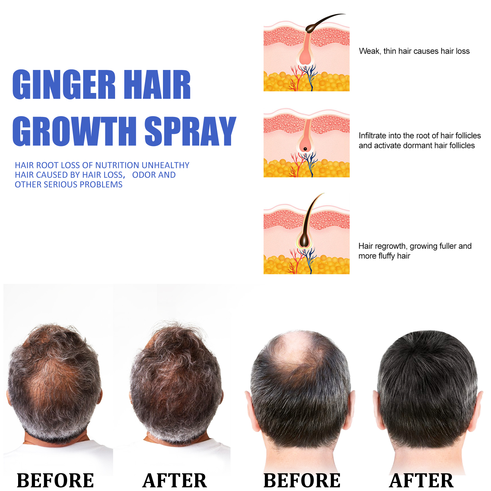 Ginger Hair Growth spray Anti  - Hair Care Products 리뷰 및 가격