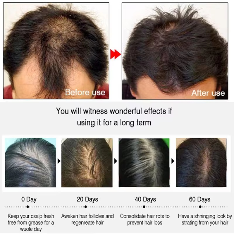 Ginger Hair Growth spray Anti  - Hair Care Products 리뷰 및 가격