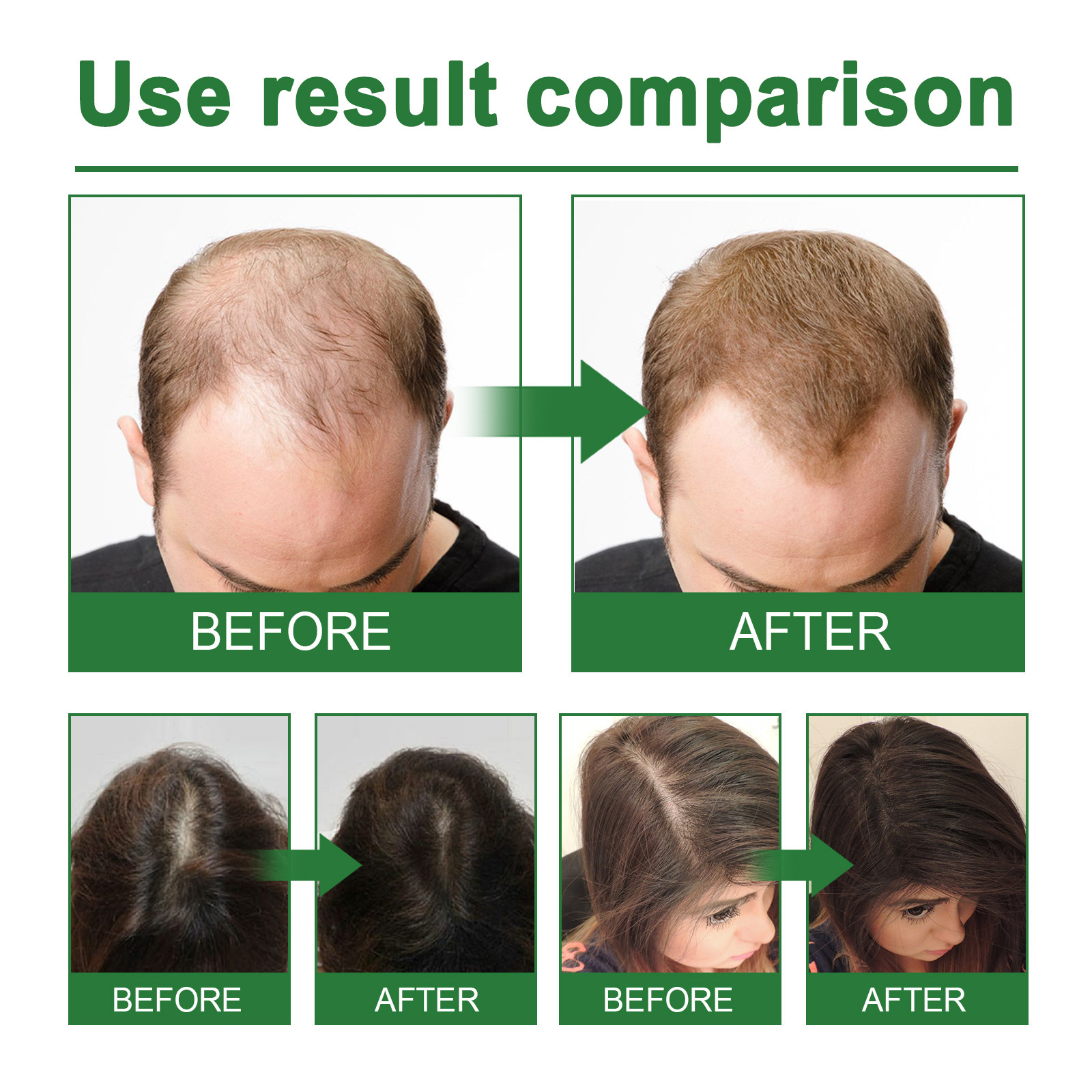 Rosemary Spray for Hair Nouris - Hair Care Natur 리뷰 및 가격